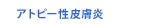 アトピー性皮膚炎