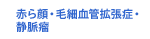 赤ら顔・毛細血管拡張症・静脈瘤