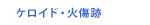 ケロイド・火傷跡