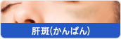 肝斑(かんぱん)