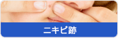 ニキビ跡