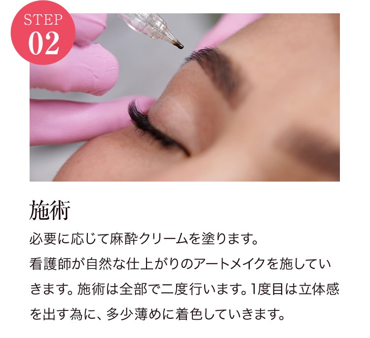 STEP02 施術
