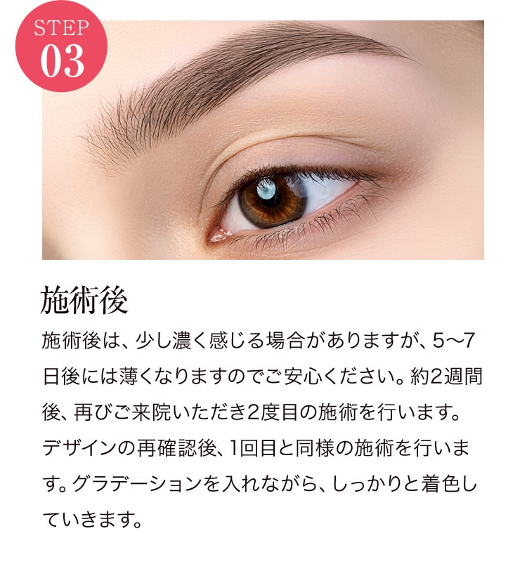 STEP03 施術後