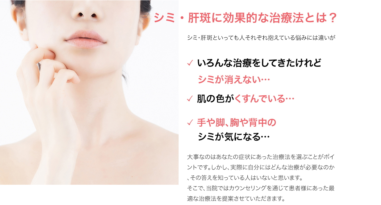 シミ・肝班に効果的な治療とは?
