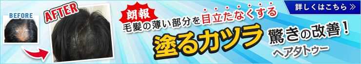 朗報 毛髪の薄い部分を目立たなくする塗るカツラヘアタトゥー驚きの改善!