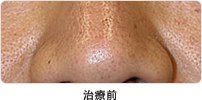治療前