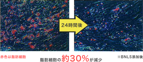 脂肪細胞の約30％が減少