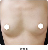 治療前