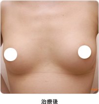 治療後