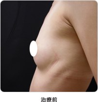 治療前