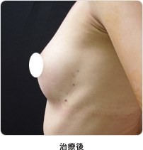 治療後