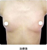 治療後