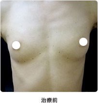 治療前