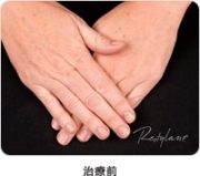 治療前