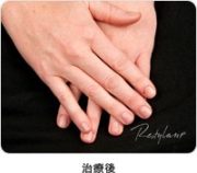 治療後