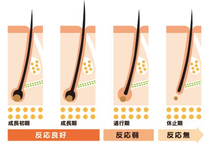 毛母細胞の分裂の図