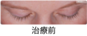 治療前
