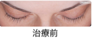 治療前