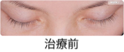 治療前