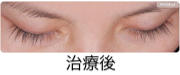 治療後