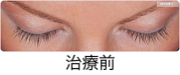治療前