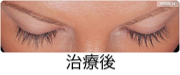 治療後