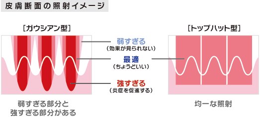 皮膚断面の照射イメージ