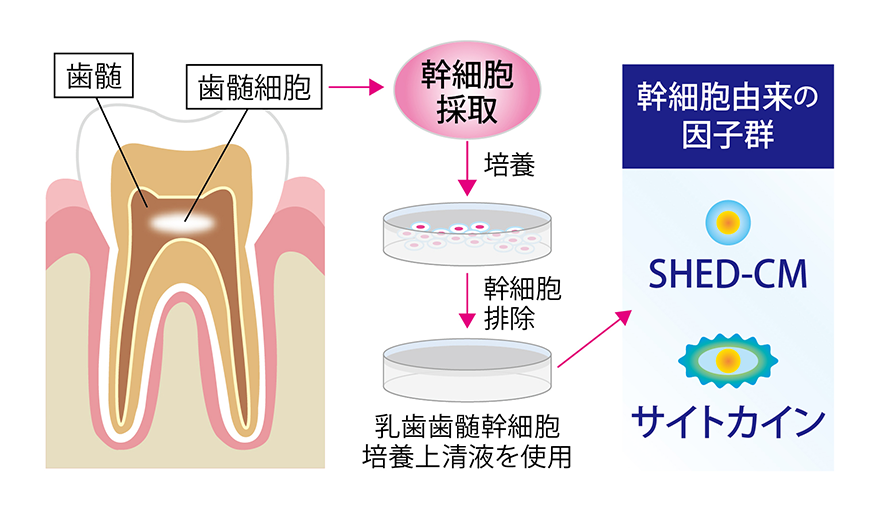 乳歯歯髄幹細胞培養上清液の治療のメカニズム