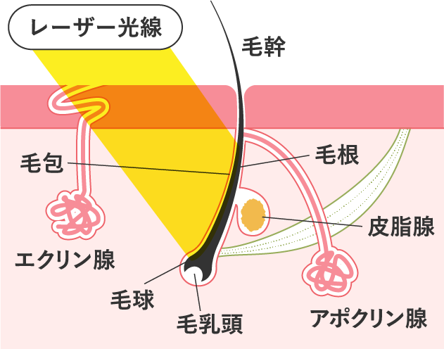 医療脱毛のイメージ