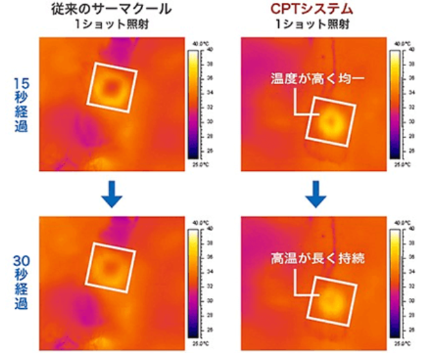 たるみが引き締まる仕組み-sp2