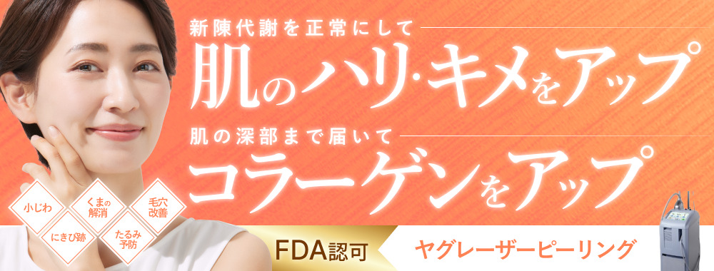 ヤグレーザーピーリング 小じわ・たるみ・赤ら顔などのお悩みに　たるみ　口元の しわ　目元のしわ　にきび跡　くま