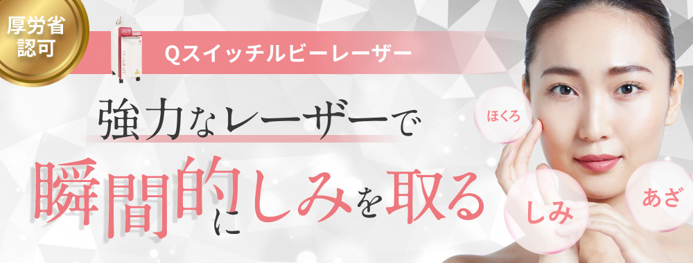 Qスイッチルビーレーザー しみやあざなどを、傷跡残さず治療する　そばかす　老人性色素斑　脂漏性角化症　カフェオレ斑　扁平母斑