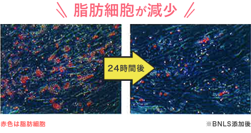 脂肪細胞の約30％が減少
