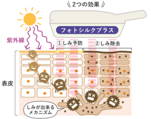 UPL（U-Shape Pulse Light）でメラニンに反応し、しみの色素を分解する様子