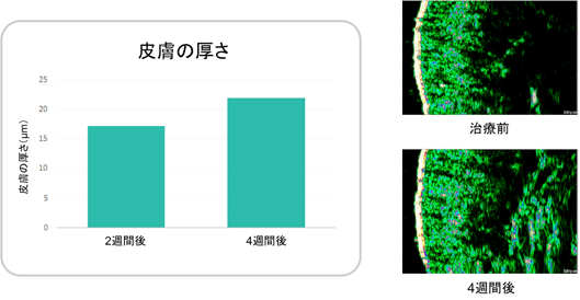 皮膚の厚さ