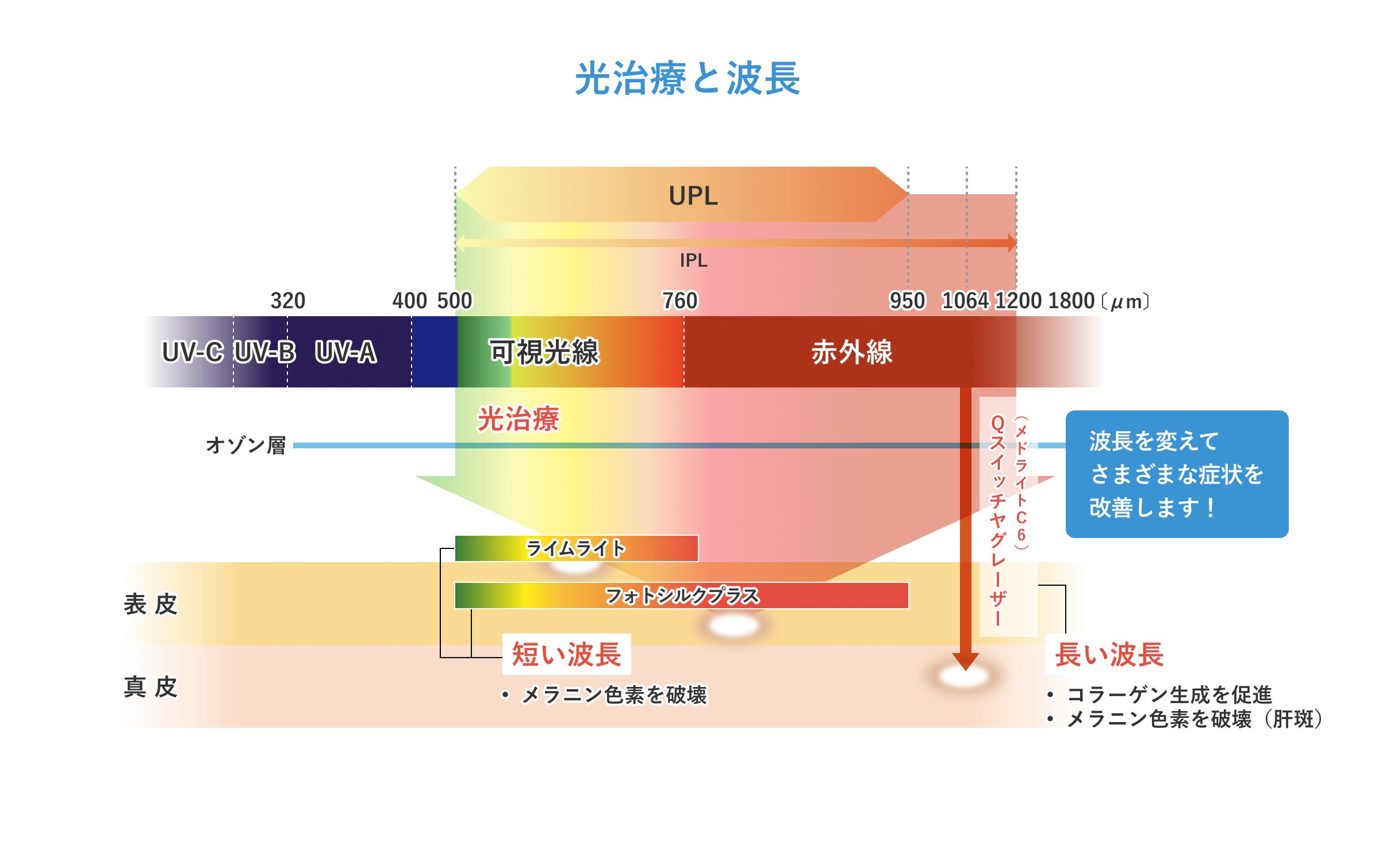 光治療と波長