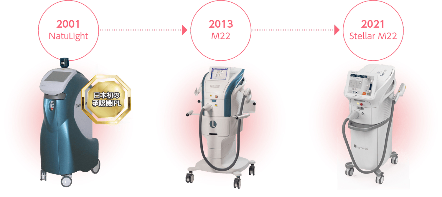 M22の年代変化