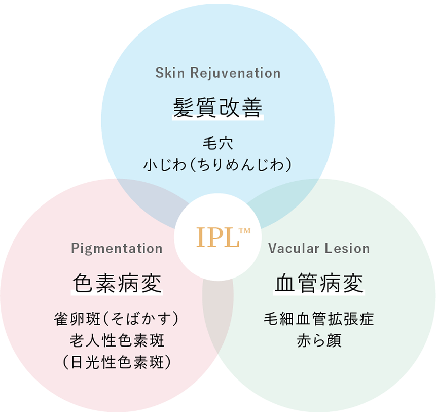 IPL3つの表