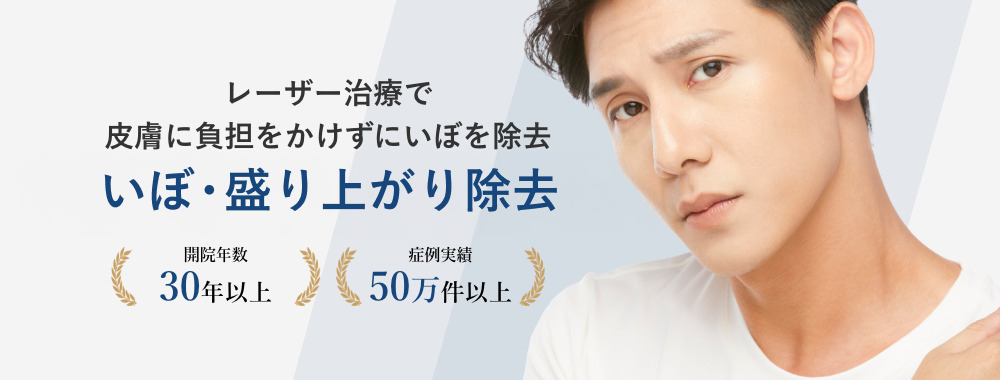 レーザー治療で皮膚に負担をかけずにいぼを除去いぼ・盛り上がり・ウオノメ除去