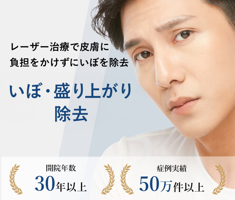 レーザー治療で皮膚に負担をかけずにいぼを除去いぼ・盛り上がり・ウオノメ除去