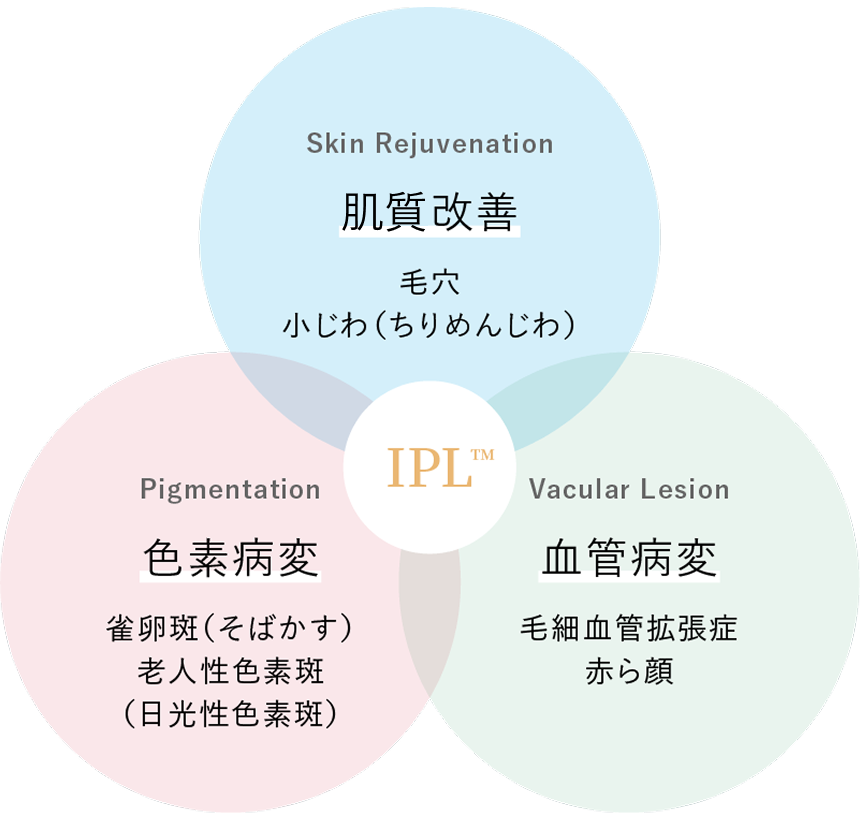 IPL3つの表