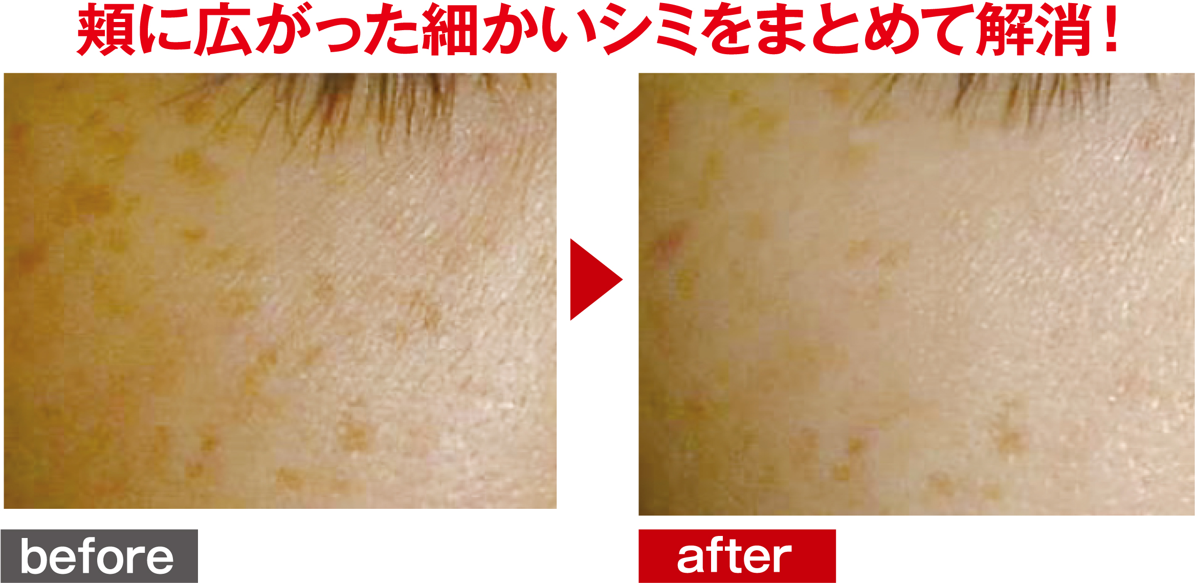 ステラM22症例写真