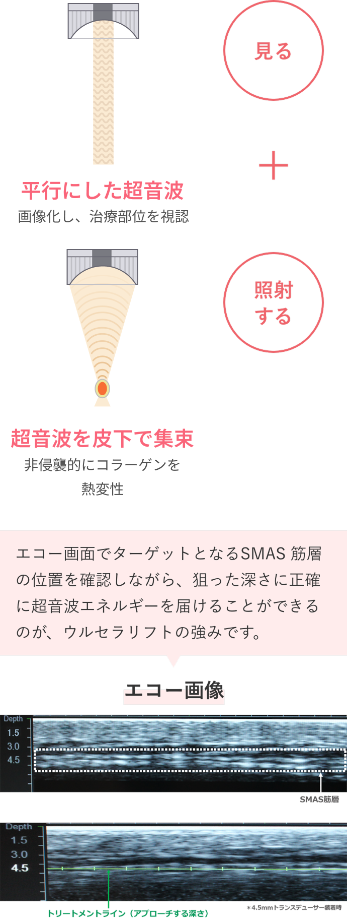 超音波で「見ながら、狙った深さにエネルギーを届ける」