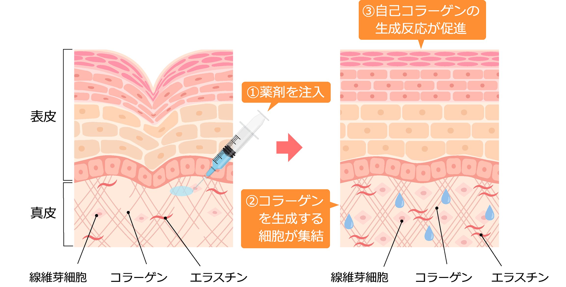 ジュベルックの肌の変化