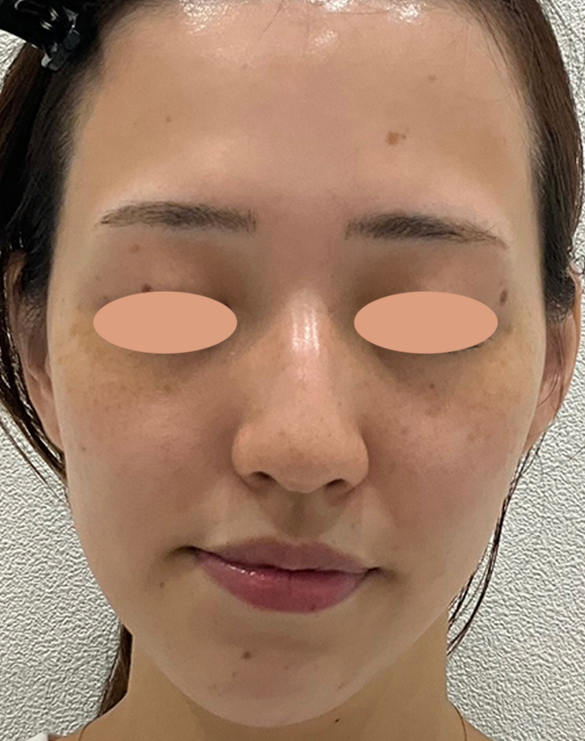 After