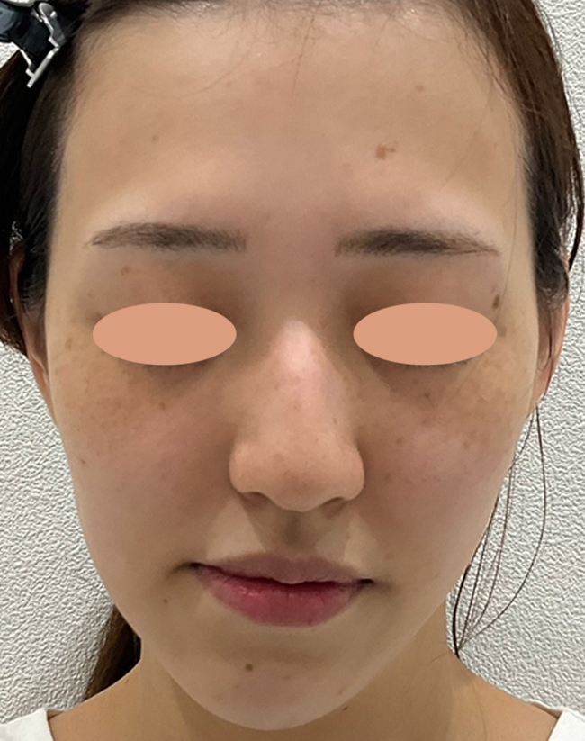 Before