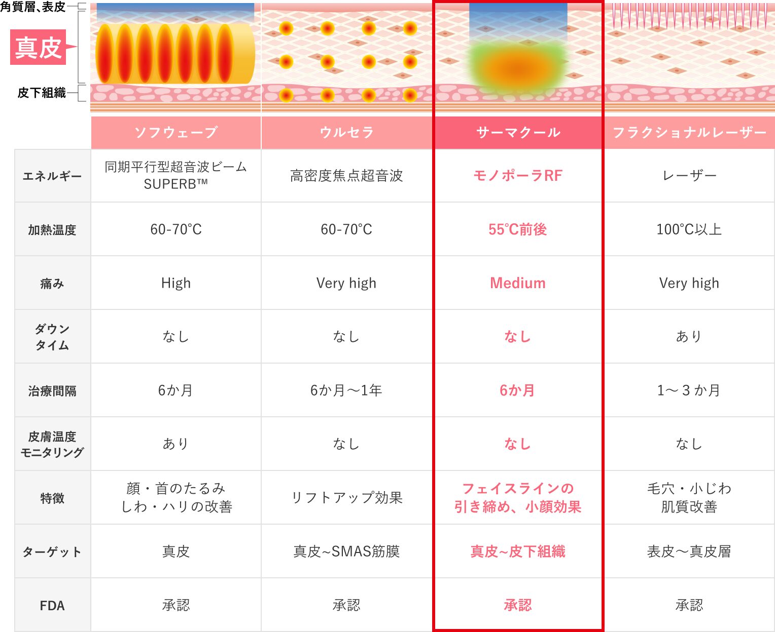 サーマクールFLX/CPT｜美容皮膚科シロノクリニック｜恵比寿院