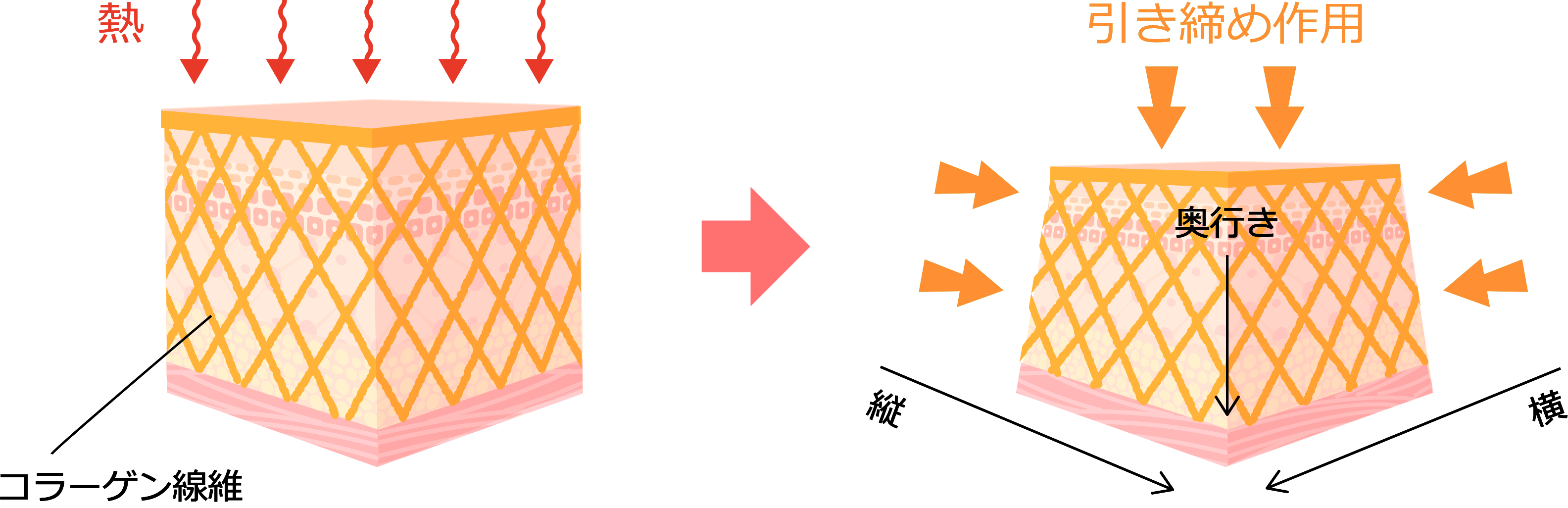 サーマクールボディのメガニズム3