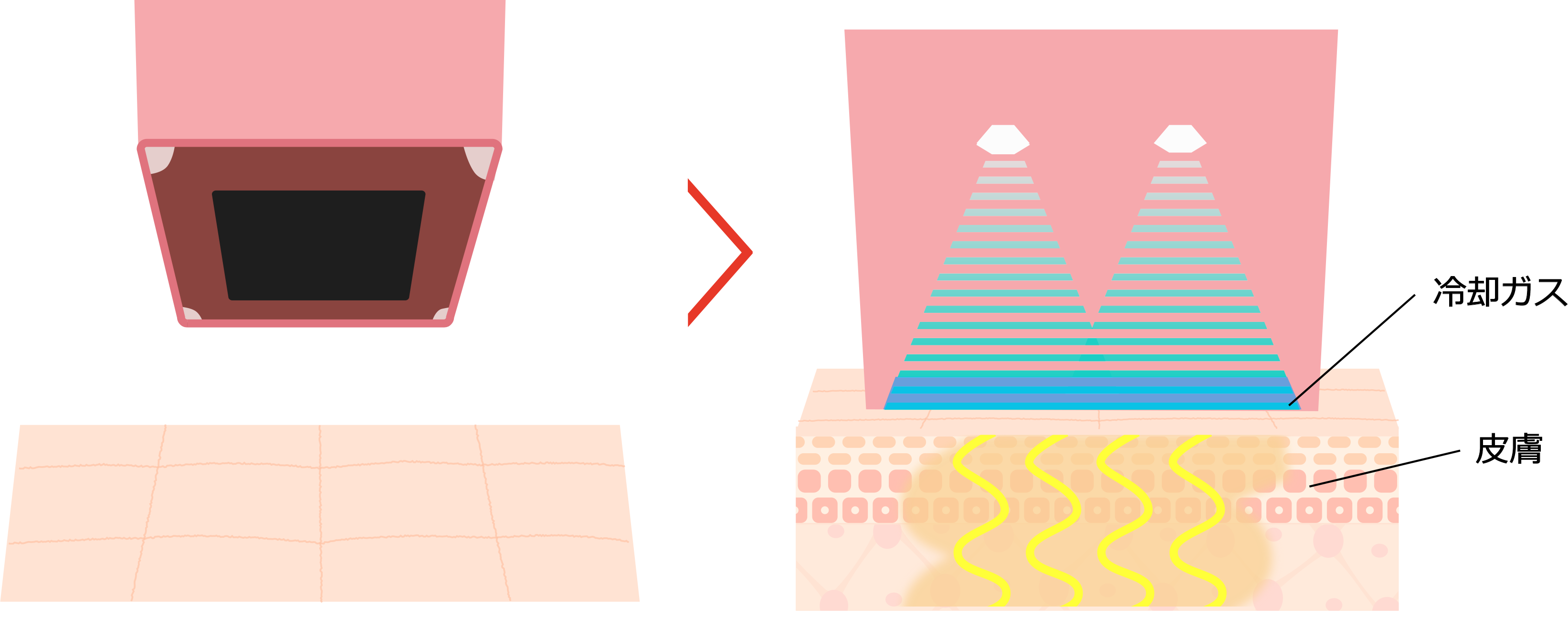 サーマクールボディのメガニズム4