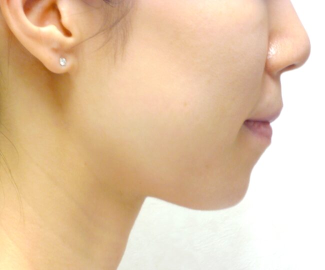After